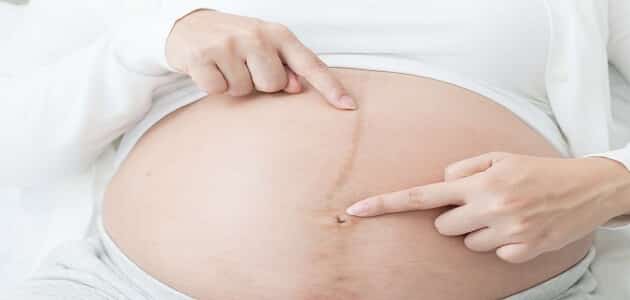  معرفة نوع الجنين من شكل البطن