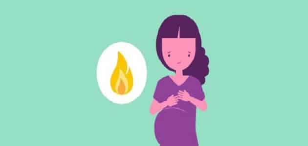 حرقان المعدة للحامل وجنس الجنين