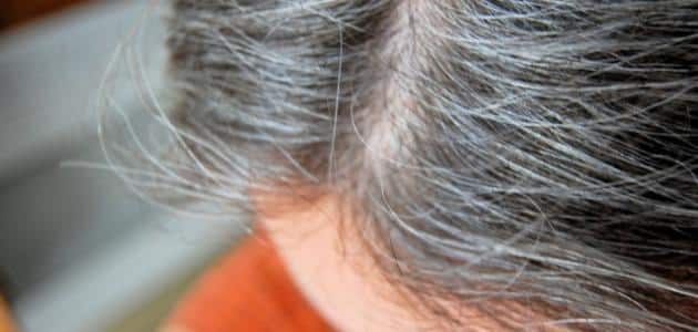 ظهور الشعر الابيض في سن الثلاثين