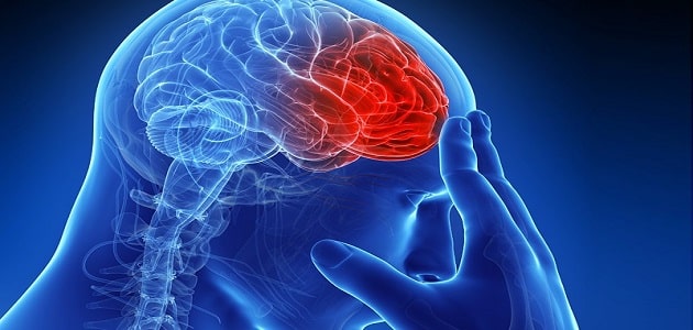 أعراض جلطة المخ عند الشباب