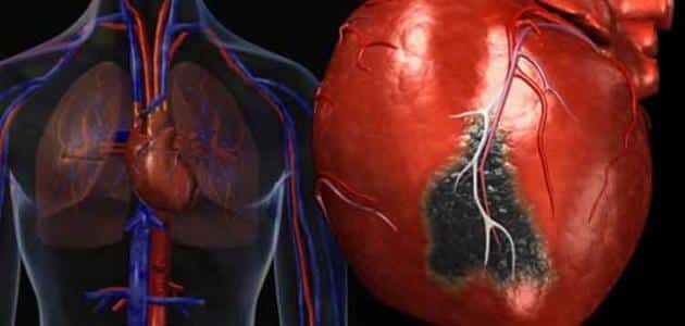 هل ارتفاع إنزيمات القلب خطير
