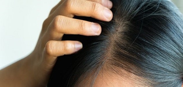 دواء تساقط الشعر من الصيدلية للنساء