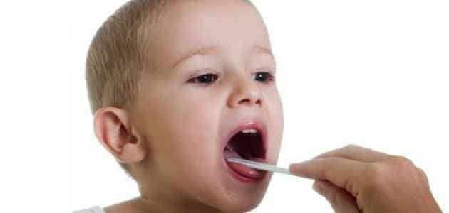 علاج بحة الصوت والتهاب الحلق للأطفال