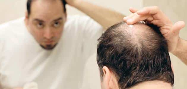 علاج تساقط الشعر للرجال وتكثيفه