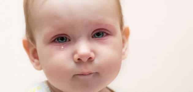 أمراض العيون عند الأطفال