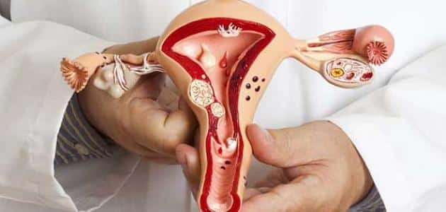 هل نزول افرازات بنية في موعد الدورة من علامات الحمل أم لا