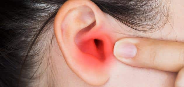 التهاب حاد في الأذن الوسطى