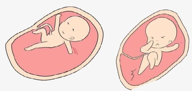 حركة الجنين أسفل البطن ولد