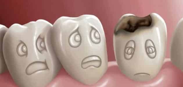 سقوط الأسنان في المنام للمتزوجة