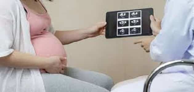 تجارب الحوامل مع الورم الليفي