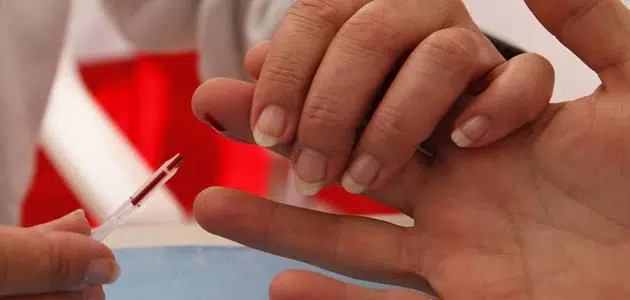 متوسط عمر مريض الإيدز بدون علاج