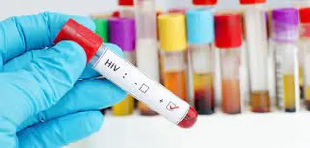 كم يستغرق تحليل الإيدز في المختبر
