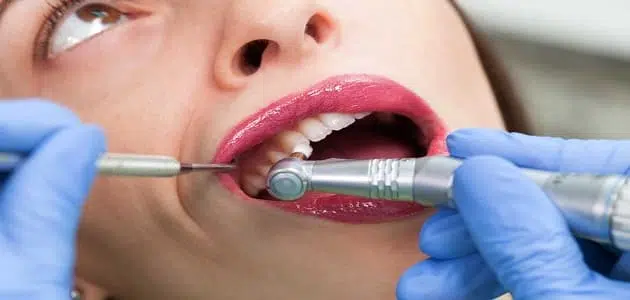 تفسير حلم تنظيف الأسنان من التسوس للعزباء