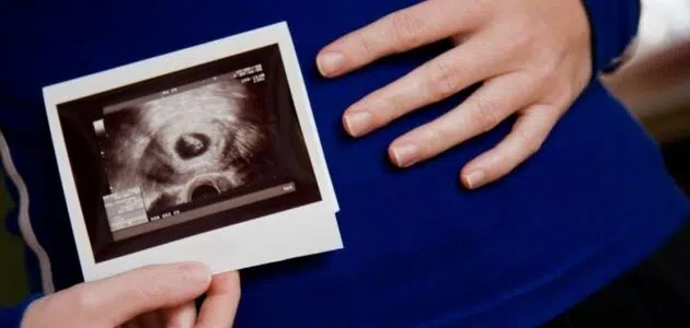 كيف يكون شكل بطن الحامل بولد بالشهر الثالث