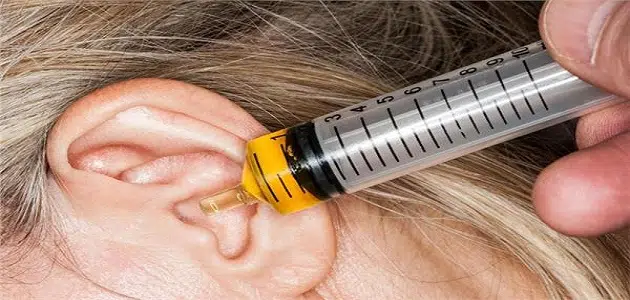 علاج شمع الأذن بالطب البديل